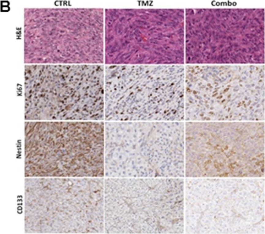Detection of Human Nestin by Immunohistochemistry