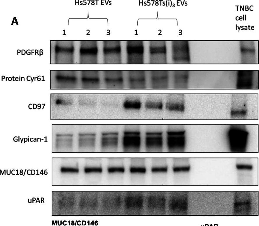 Detection of PDGF R beta  by Western Blot