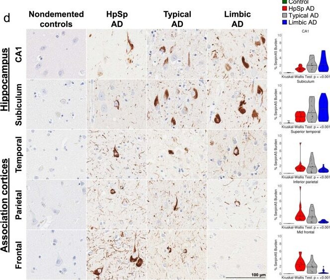 Detection of Serpin A5 by Immunohistochemistry