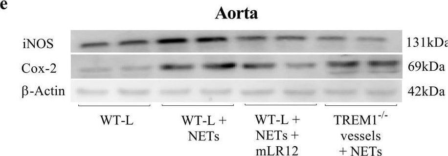 Detection of TREM-1 by Western Blot