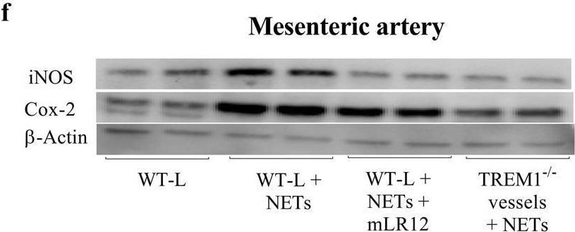 Detection of TREM-1 by Western Blot