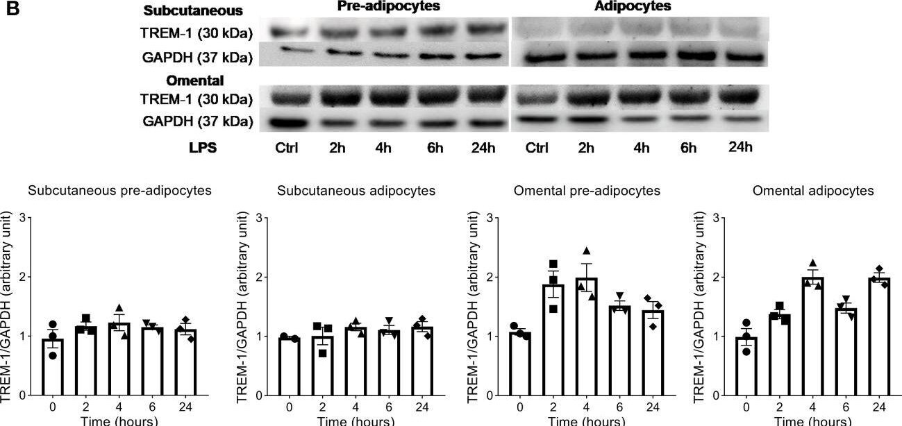 Detection of TREM-1 by Western Blot