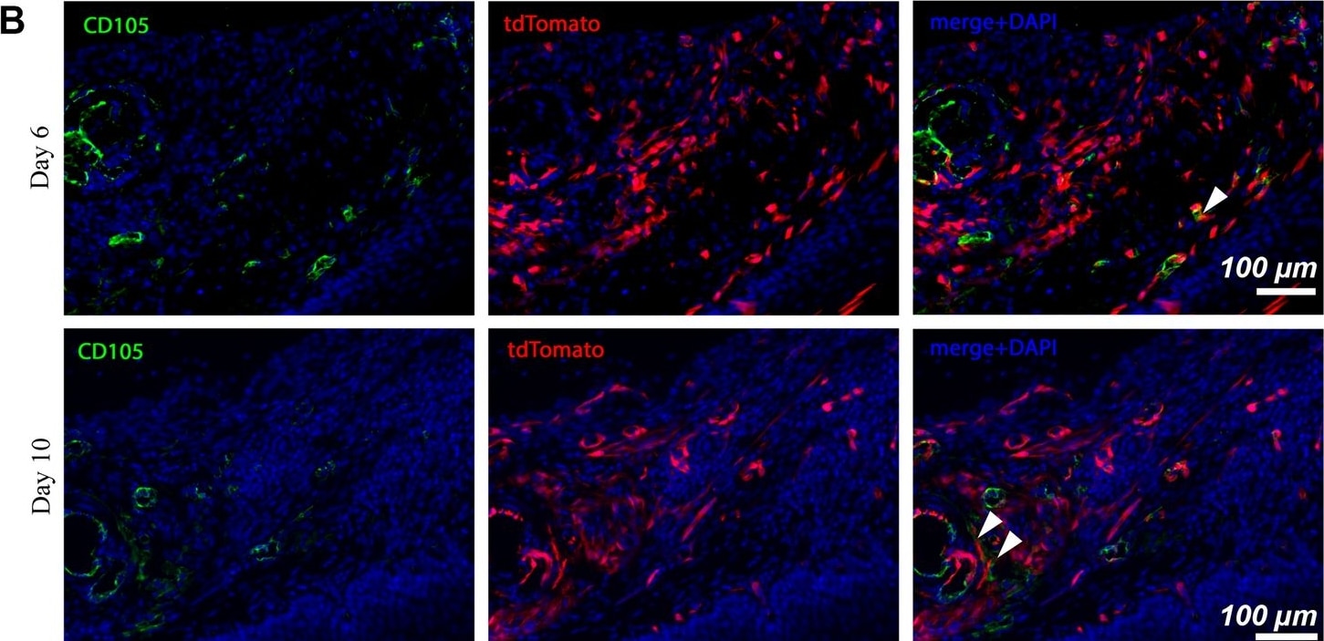 Detection of Endoglin/CD105 by Immunohistochemistry