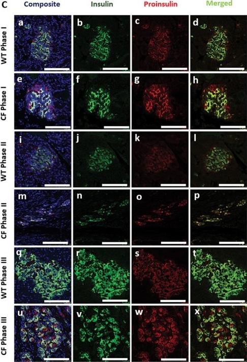 Detection of Proinsulin by Immunocytochemistry/ Immunofluorescence