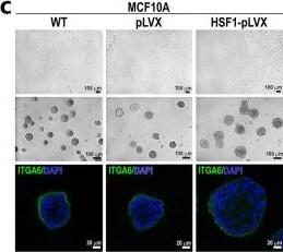 Detection of Integrin alpha 6/CD49f by Immunocytochemistry/ Immunofluorescence