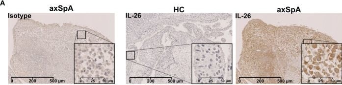 Detection of IL-26/AK155 by Immunohistochemistry