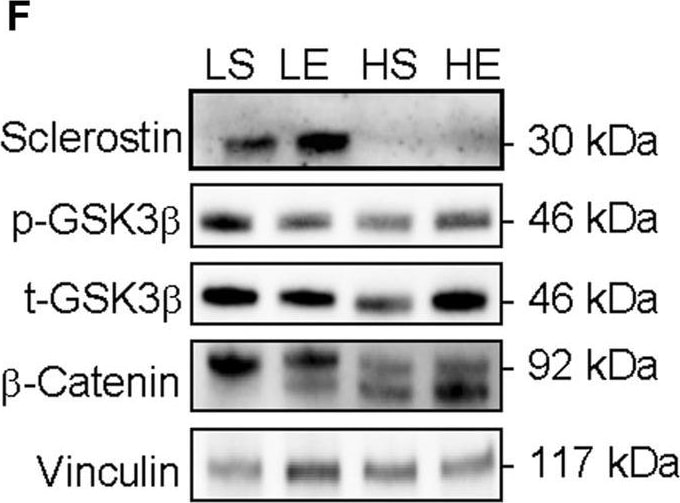 Detection of SOST/Sclerostin by Western Blot