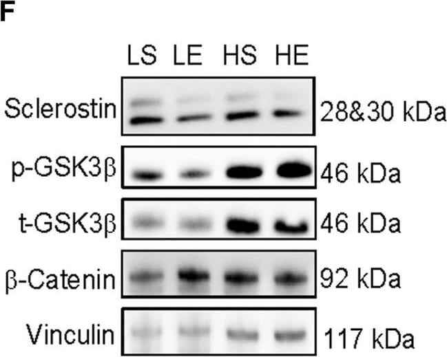 Detection of SOST/Sclerostin by Western Blot