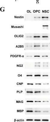 Detection of A2B5 by Western Blot