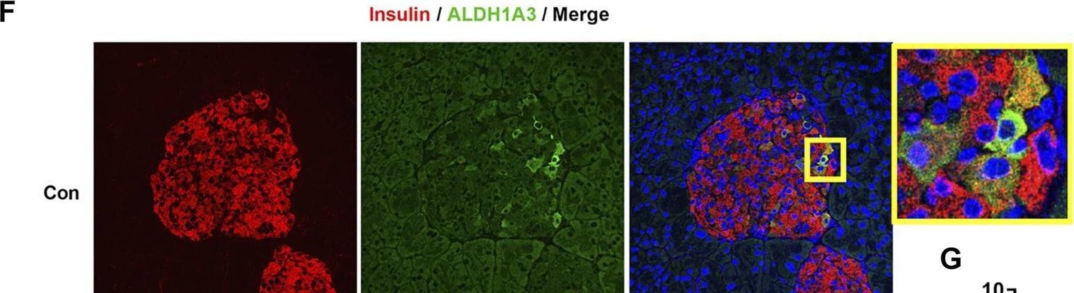 Detection of Insulin by Immunohistochemistry