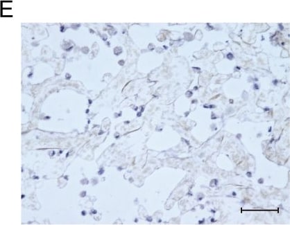 Detection of Human Osteocalcin by Immunocytochemistry/Immunofluorescence