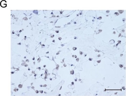 Detection of Human Osteocalcin by Immunocytochemistry/Immunofluorescence