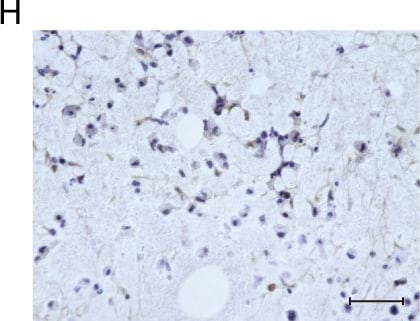 Detection of Human Osteocalcin by Immunocytochemistry/Immunofluorescence