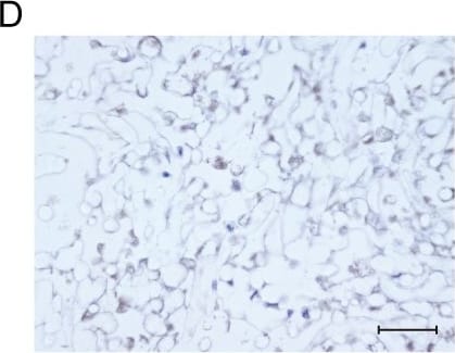 Detection of Human Osteocalcin by Immunocytochemistry/Immunofluorescence