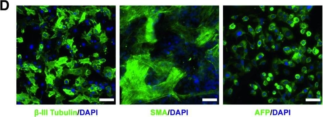 Detection of Human Human/Mouse/Rat alpha-Smooth Muscle Actin Antibody by Immunocytochemistry/ Immunofluorescence
