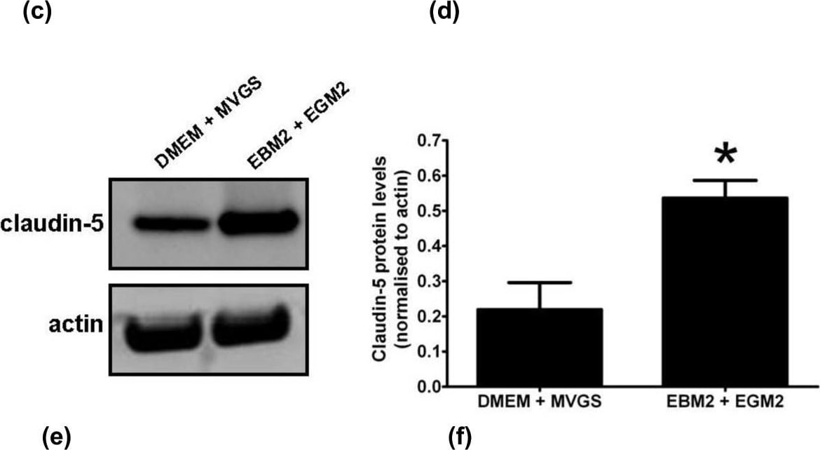 Detection of Rat alpha-Smooth Muscle Actin by Western Blot