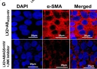 Detection of alpha-Smooth Muscle Actin by Immunocytochemistry/ Immunofluorescence