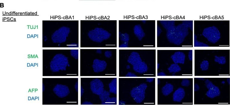 Detection of alpha-Smooth Muscle Actin by Immunocytochemistry/ Immunofluorescence