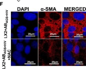 Detection of alpha-Smooth Muscle Actin by Immunocytochemistry/ Immunofluorescence