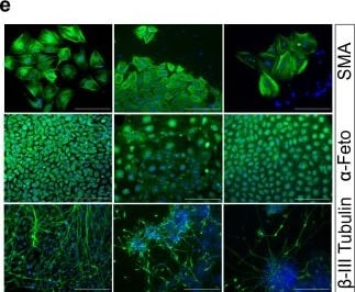 Detection of alpha-Smooth Muscle Actin by Immunocytochemistry/ Immunofluorescence