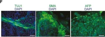 Detection of alpha-Smooth Muscle Actin by Immunohistochemistry
