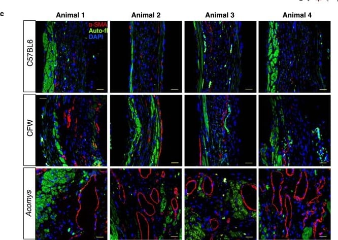 Detection of alpha-Smooth Muscle Actin by Immunohistochemistry