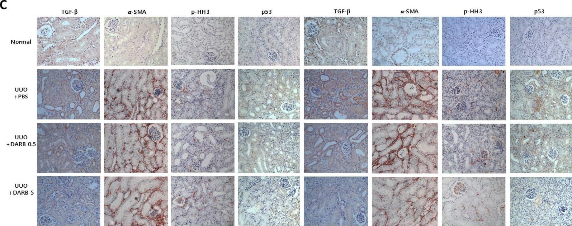 Detection of alpha-Smooth Muscle Actin by Immunohistochemistry