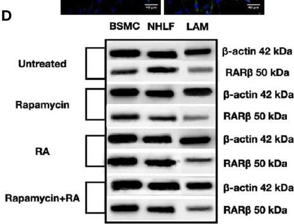Detection of alpha-Smooth Muscle Actin by Western Blot