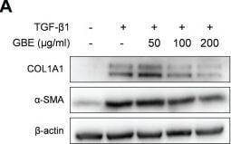 Detection of alpha-Smooth Muscle Actin by Western Blot