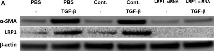 Detection of alpha-Smooth Muscle Actin by Western Blot