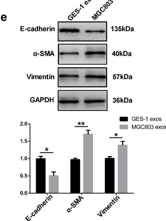 Detection of alpha-Smooth Muscle Actin by Western Blot