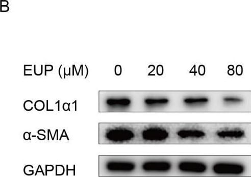 Detection of alpha-Smooth Muscle Actin by Western Blot