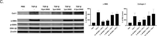 Detection of alpha-Smooth Muscle Actin by Western Blot