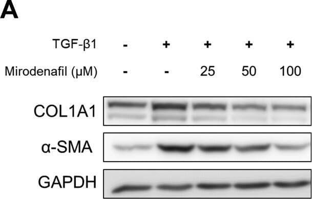 Detection of alpha-Smooth Muscle Actin by Western Blot
