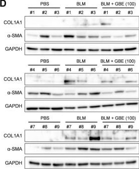 Detection of alpha-Smooth Muscle Actin by Western Blot