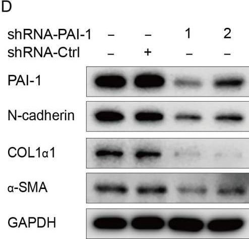 Detection of alpha-Smooth Muscle Actin by Western Blot