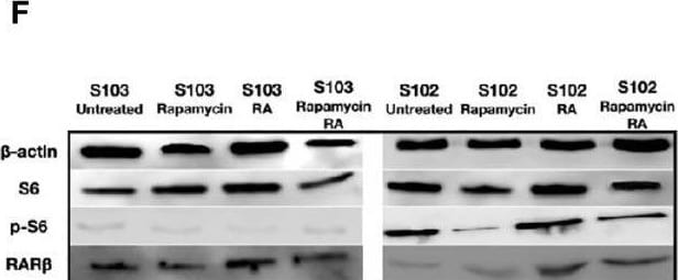 Detection of alpha-Smooth Muscle Actin by Western Blot