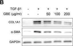 Detection of alpha-Smooth Muscle Actin by Western Blot