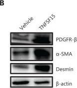 Detection of alpha-Smooth Muscle Actin by Western Blot