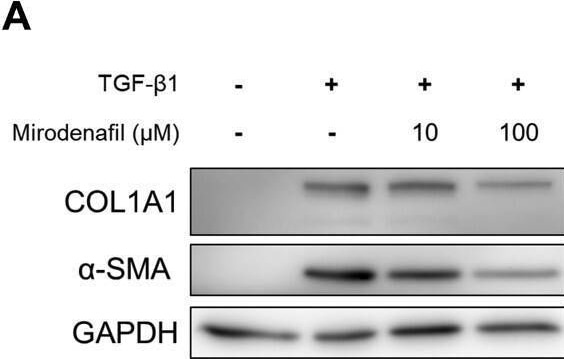 Detection of alpha-Smooth Muscle Actin by Western Blot