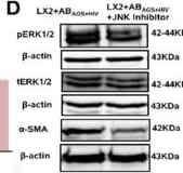 Detection of alpha-Smooth Muscle Actin by Western Blot