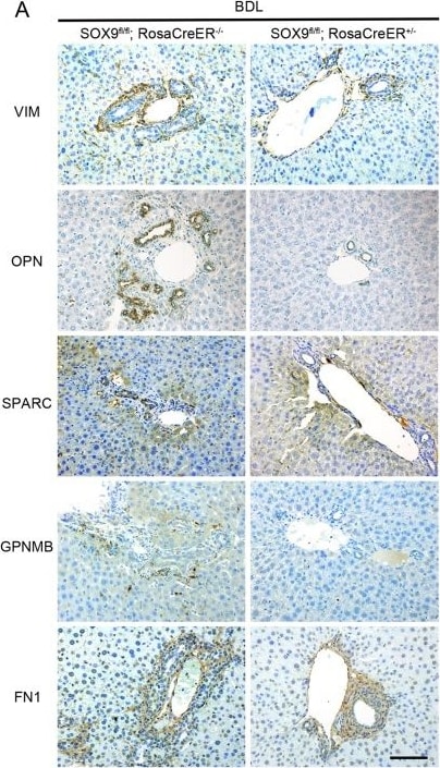 Detection of Osteopontin/OPN by Immunohistochemistry