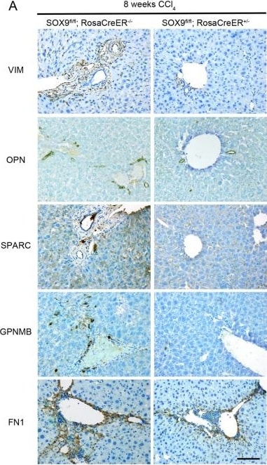 Detection of Osteopontin/OPN by Immunohistochemistry