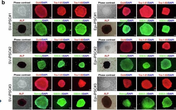 Detection of SSEA-4 by Immunocytochemistry/ Immunofluorescence