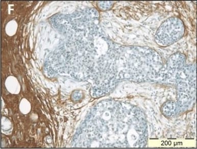 Detection of Human Decorin by Immunohistochemistry