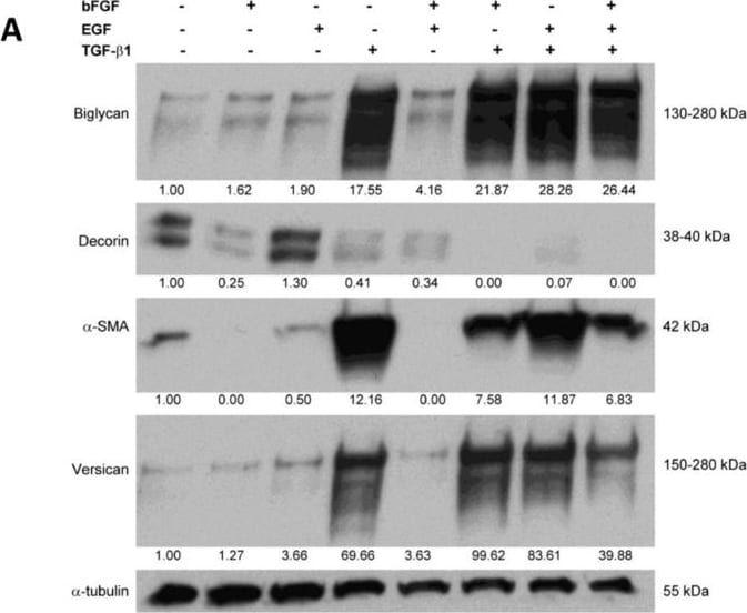 Detection of Human Decorin by Western Blot