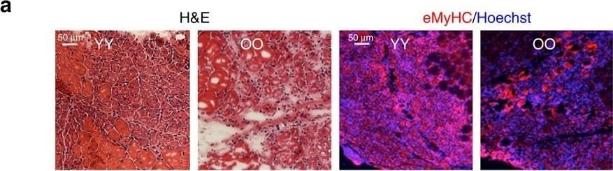 Detection of Mouse Albumin by Immunohistochemistry