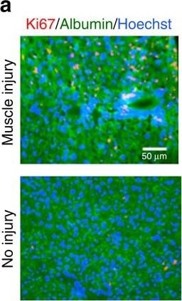 Detection of Mouse Albumin by Immunohistochemistry