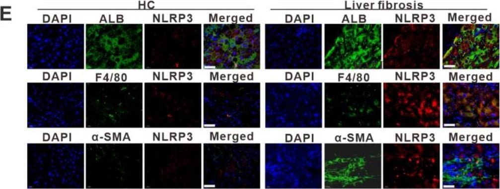Detection of Human Albumin by Immunohistochemistry