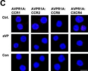 Detection of CCR1 by Immunocytochemistry/ Immunofluorescence